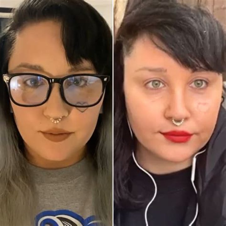 Amanda Bynes' Face Tattoo Removal Journey