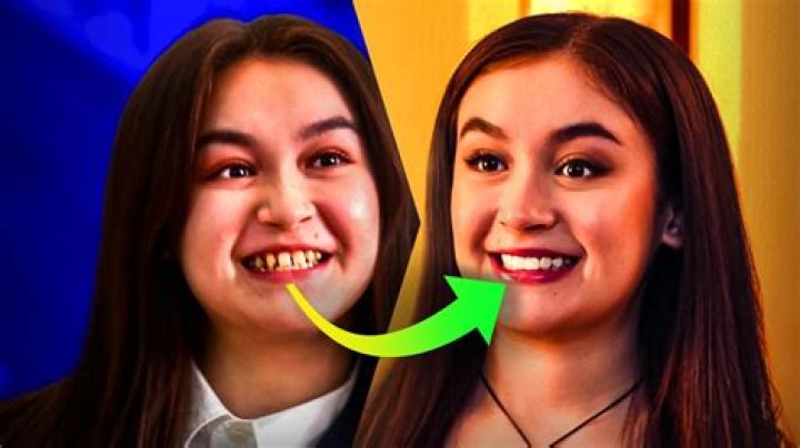 Unveiling The Enigma Of Anna Cathart's Teeth: Discoveries And Insights