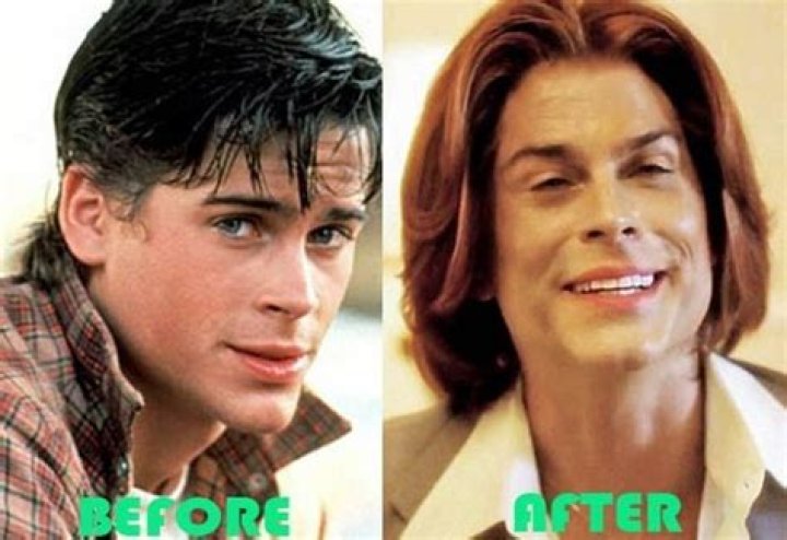 The Ultimate Guide To Rob Lowe's Plastic Surgery: Uncovering The Truth