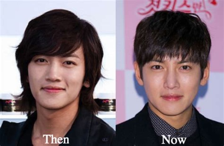 Unlocking The Enigma Of "Ji Chang Wook Plastic Surgery": Revelations And Perspectives