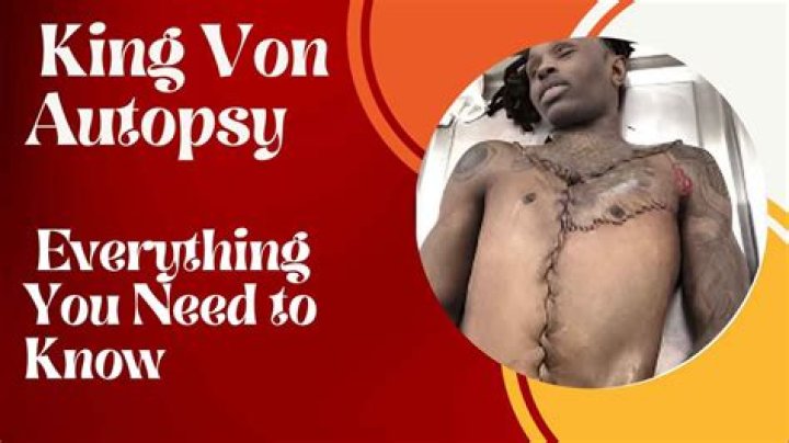King Von Autopsy Results Revealed