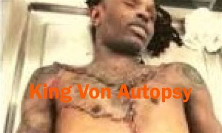 King Von's Autopsy Unravels Hidden Insights
